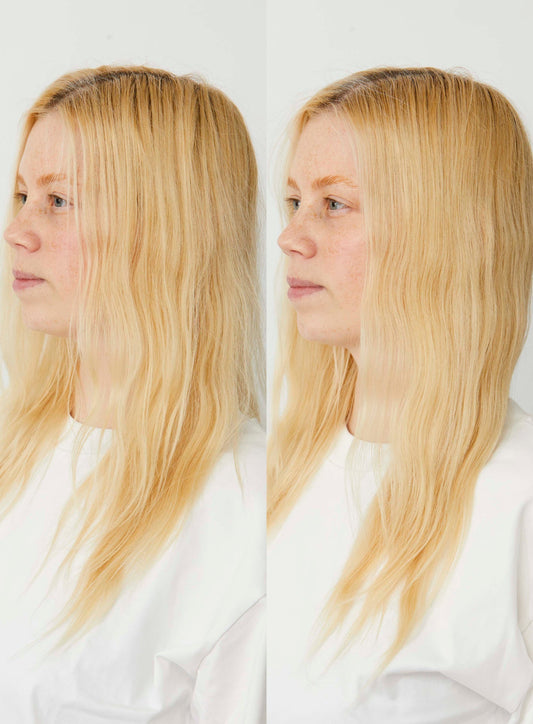 7 Tips to Treat Dry, Frizzy Hair