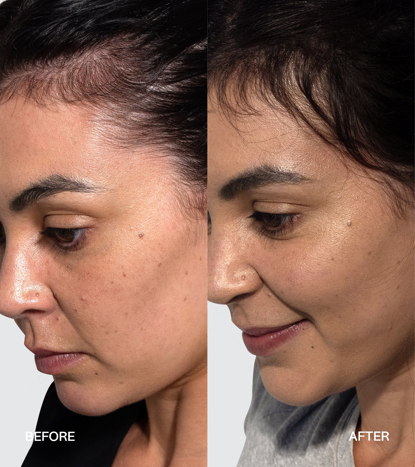 Reviews Real Results TYPEBEA AU NZ